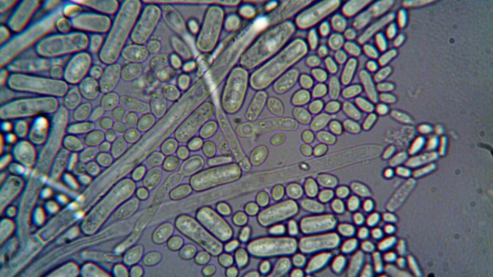 female dog cat urinary tract infection bacteria E.