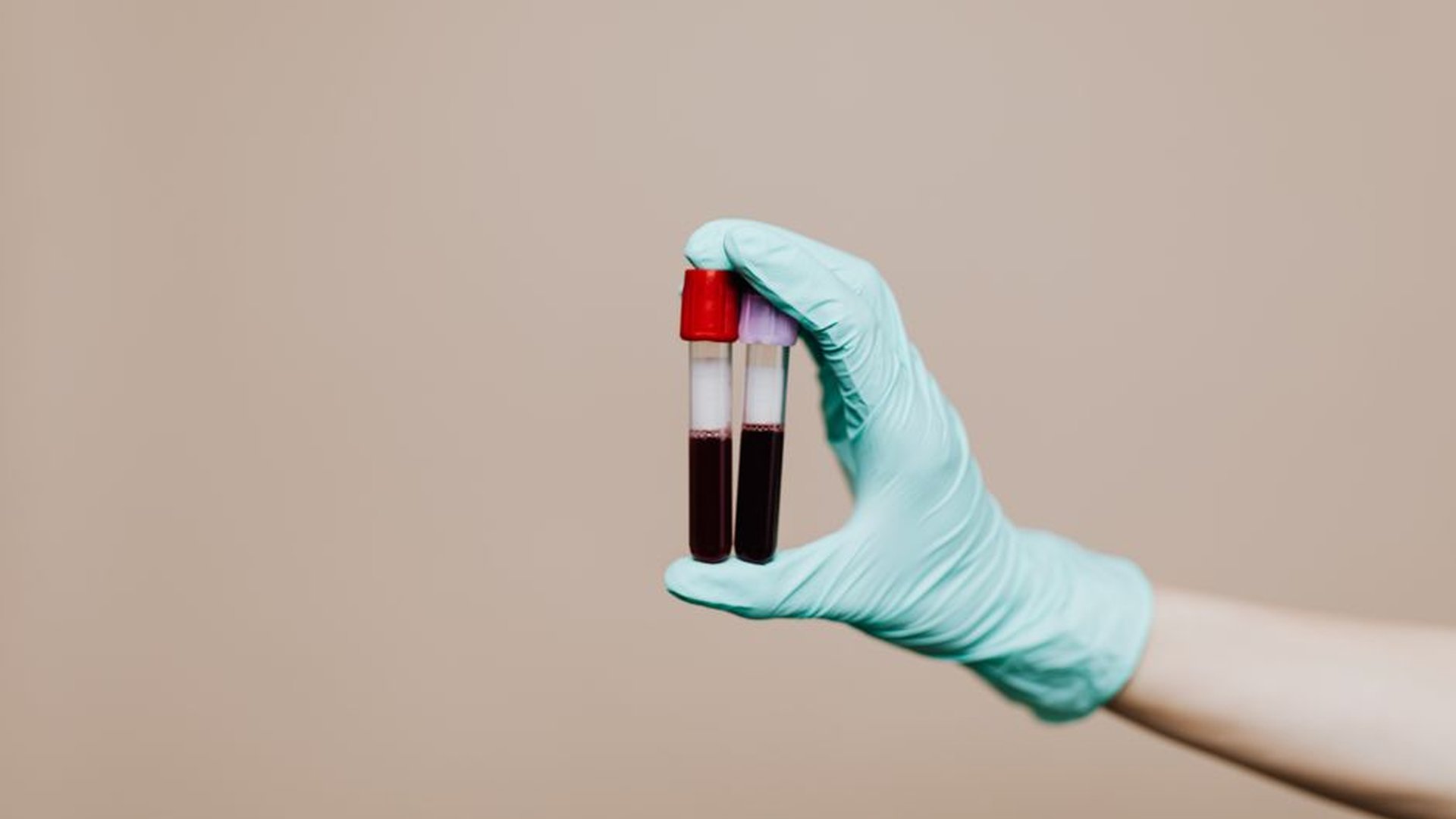 veterinarian exam dog urine sample blood test stet